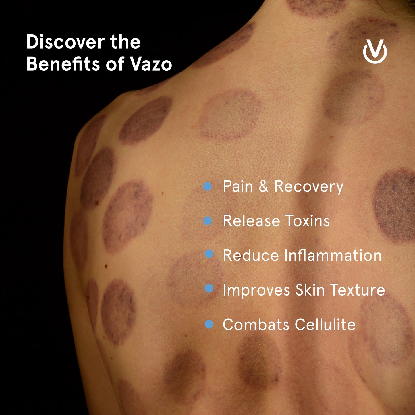 Vazo Slide: The Ultimate Smart Cupping Therapy Device