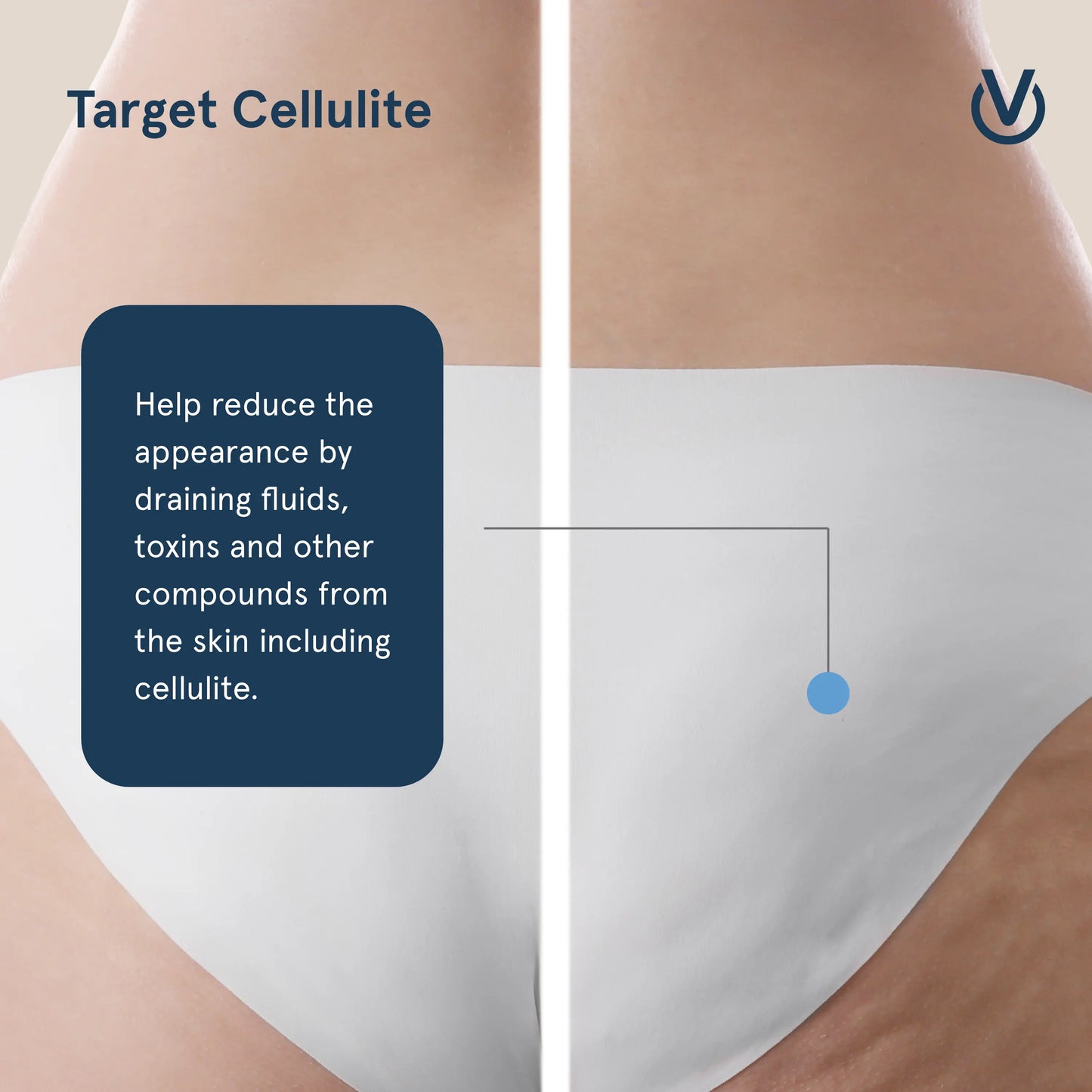 Vazo Slide: The Ultimate Smart Cupping Therapy Device